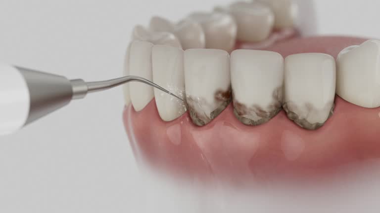 Reliable Dental Implants contractor in Walls, MS by Smile Center Dentistry